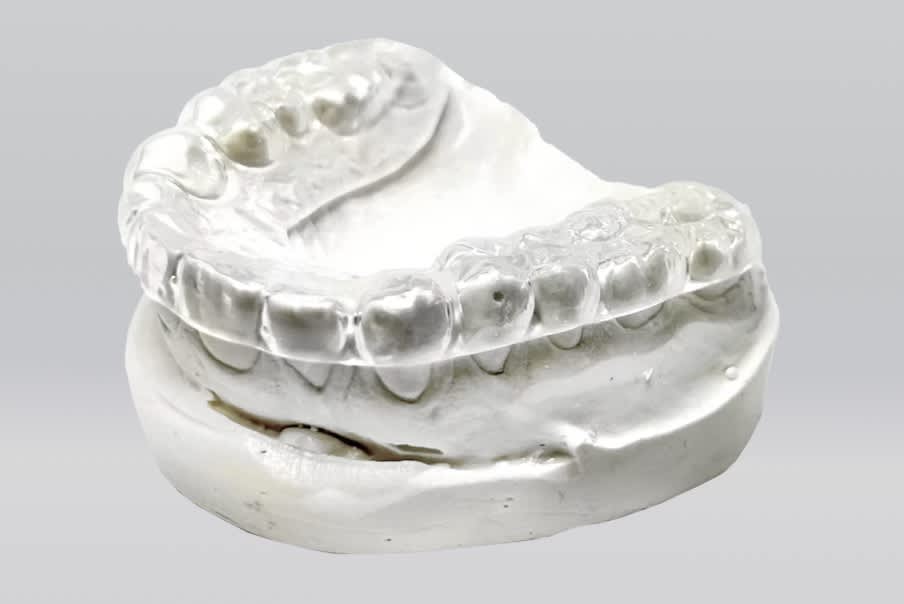 Best Mouthguards for Teeth Grinding in 2026 - Revived Smiles Custom Nightguard image 1