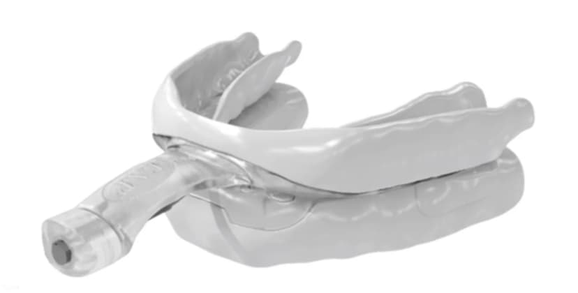 Sleep Doctor image of the Airway Management myTAP Oral Appliance